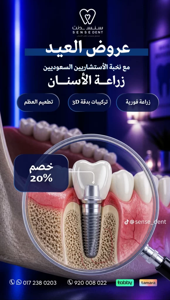 عروض زراعة الاسنان